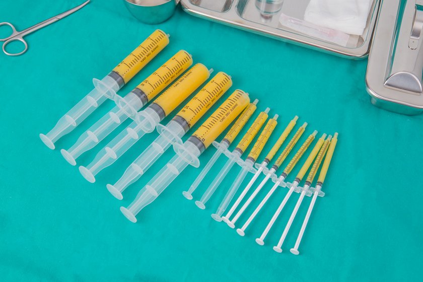 Ліпофілінг у клініці LaserOne фото №1