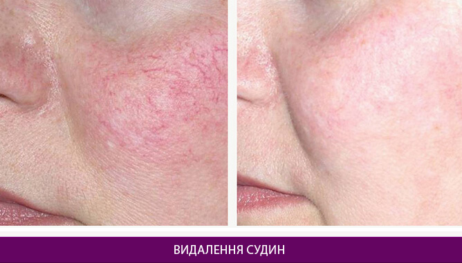 Дерматологія та косметологія - фото до и после № 1