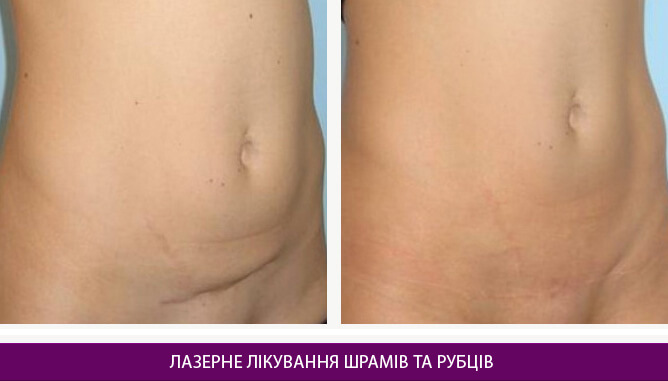 Дерматологія та косметологія - фото до и после № 2