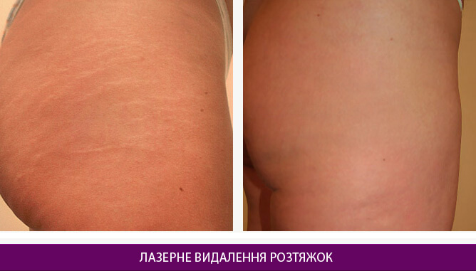 Дерматологія та косметологія - фото до и после № 3