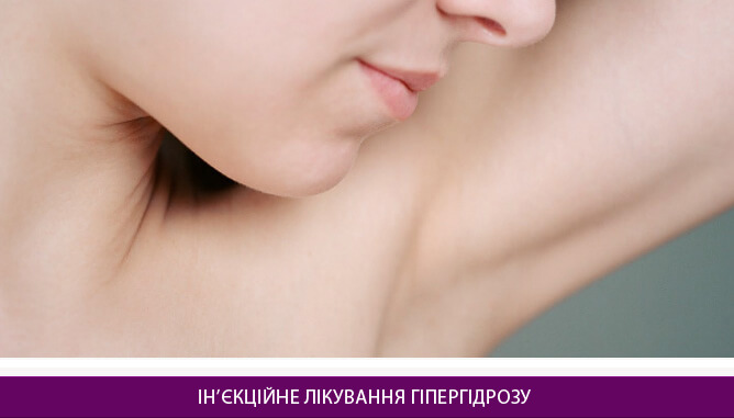Ін’єкційне лікування гіпергідрозу - фото до и после № 1